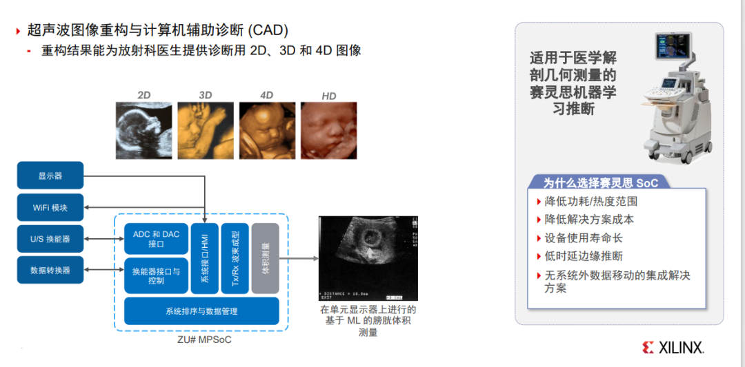 在医疗行业中,FPGA扮演什么角色? - 第6张 - FPGA线上课程平台|最全栈的FPGA学习平台|FPGA工程师认证培训 在医疗行业中,FPGA扮演什么角色? - 第6张