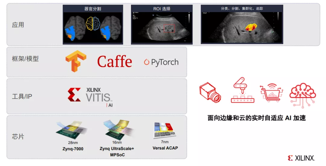 在医疗行业中,FPGA扮演什么角色? - 第7张 - FPGA线上课程平台|最全栈的FPGA学习平台|FPGA工程师认证培训 在医疗行业中,FPGA扮演什么角色? - 第7张